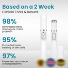 Non-Invasive Mole and Wart Removal Laser Pen 2