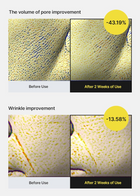 Celimax The Vita A Retinol Shot سيروم شد البشرة 3