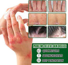 Psoriasis Cream - Herbal Plant Extracts 5