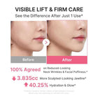 Medicube Neck Wrinkle Cream 6