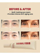 SEOUL 1988 Eye Cream – Anti-Aging Dark Circle & Wrinkle Treatment 3